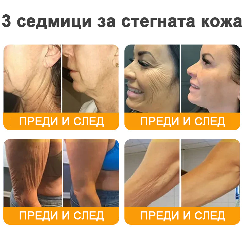 VLSVLS® Крем с пчелна отрова за регенерация на кожата (👨⚕️ подходящ за всички възрастови групи, препоръчан от AAD) 💎