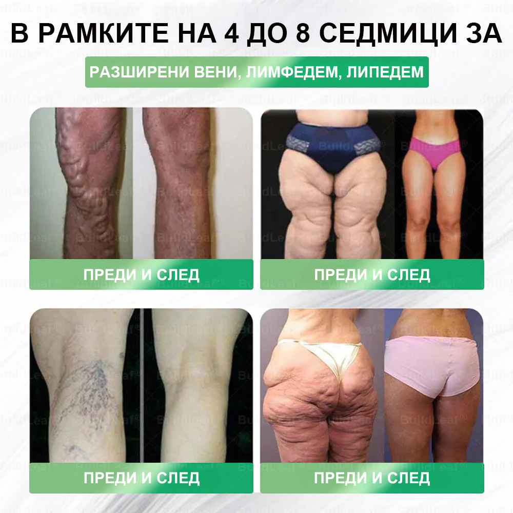 ⭐BuildLeaf® GLP-1 8-в-1 Разтвор за отслабване и здраве (веднъж дневно, видими резултати за 7 дни) ✅ Подпомага отслабването, подобрява сърдечно-съдовото здраве и контролира диабета