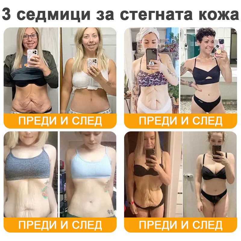 VLSVLS® Крем с пчелна отрова за регенерация на кожата (👨‍⚕️ подходящ за всички възрастови групи, препоръчан от AAD) 💎