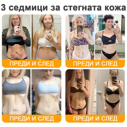 VLSVLS® Крем с пчелна отрова за регенерация на кожата (👨‍⚕️ подходящ за всички възрастови групи, препоръчан от AAD) 💎